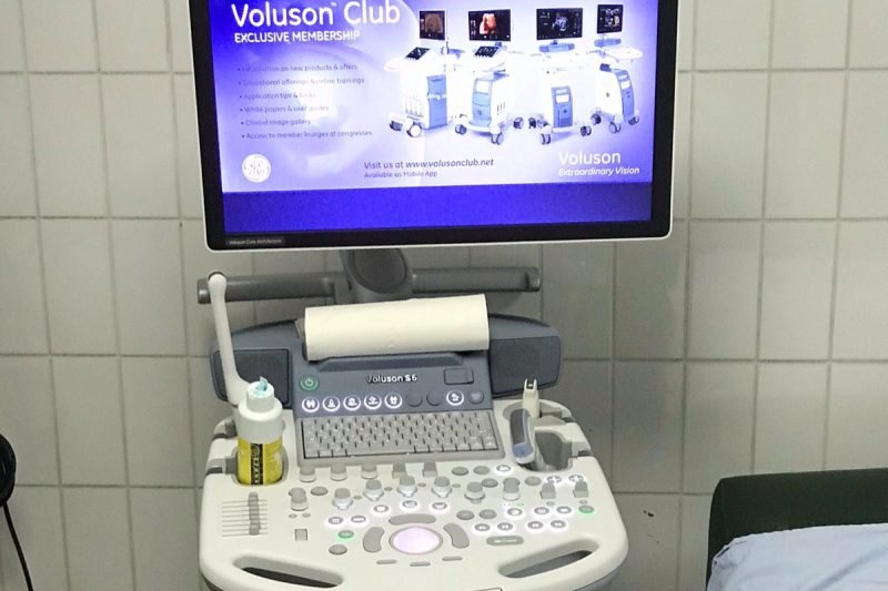 ultrazvuk01